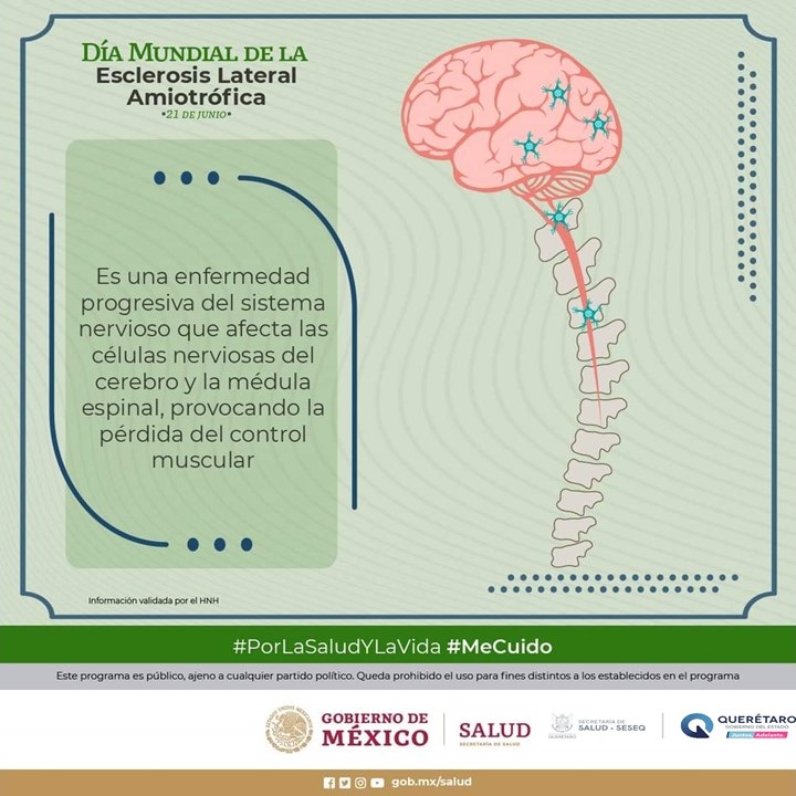 Se-suma-SESA-a-la-conmemoracion-del-Dia-Mundial-contra-la-Esclerosis-Lateral-Amiotrofica Se suma SESA a la conmemoración del Día Mundial contra la Esclerosis Lateral Amiotrófica