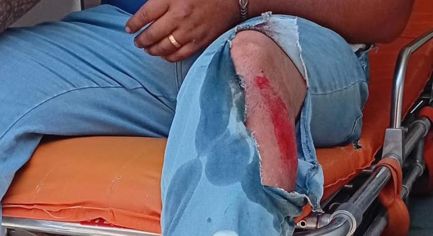 Atienden-accidente-de-motocicleta-en-El-Madrono-lesionado-presenta-heridas-leves-00002 Atienden accidente de motocicleta en El Madroño; lesionado presenta heridas leves